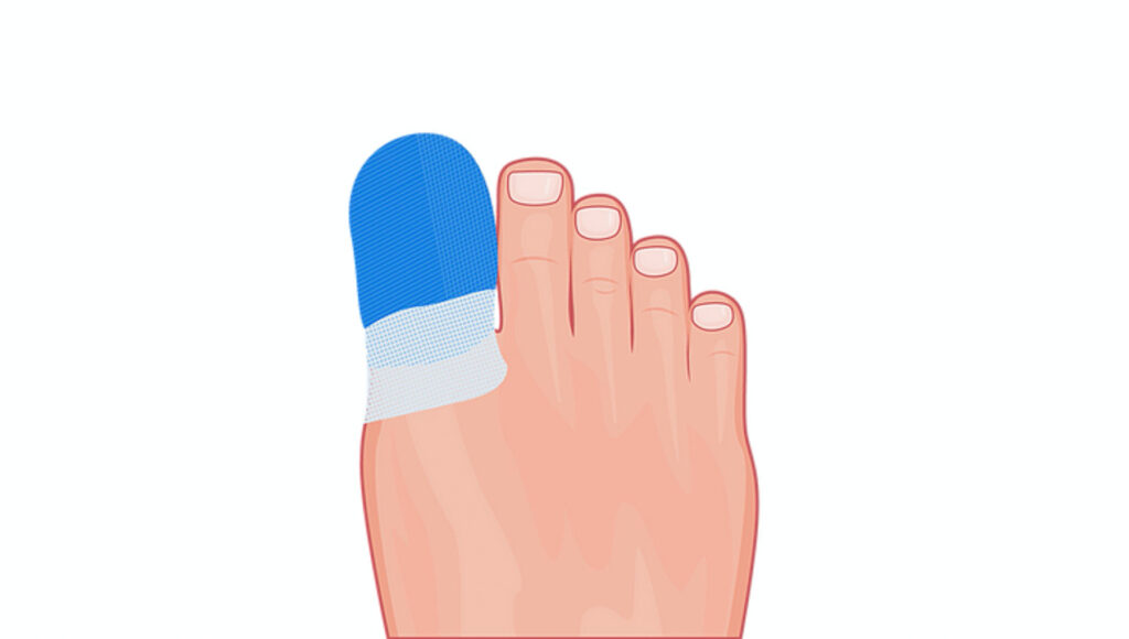 does-ingrown-toenail-surgery-hurt-afterwards-ingrown-toenail-clinics